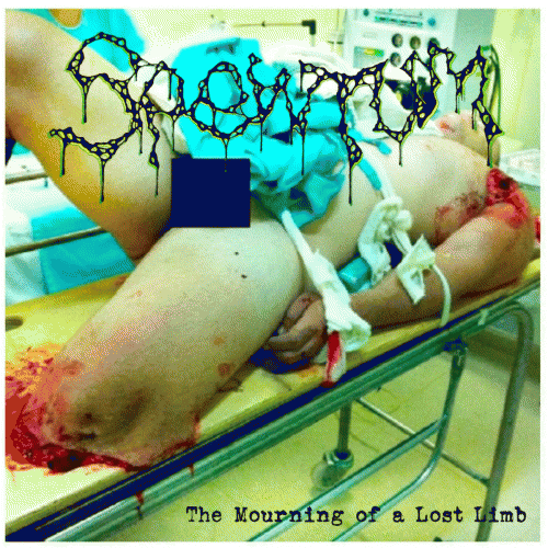 Spewtum : The Mourning of a Lost Limb